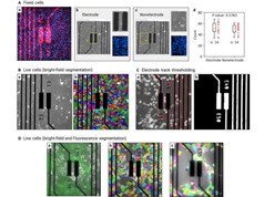 Công nghệ mới theo dõi sự phát triển của các tế bào ung thư